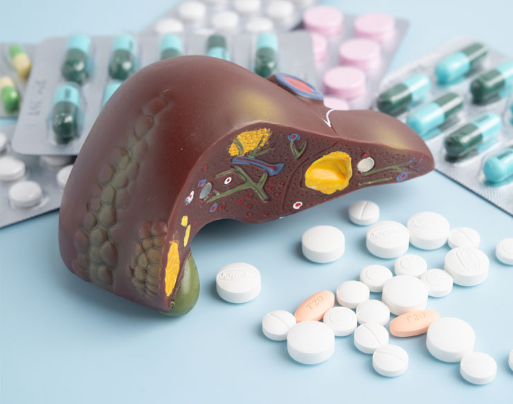 Alcohol and Liver Cancer Risk: When Does It Become Too Much?