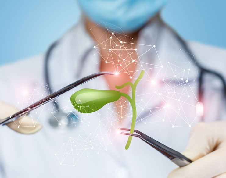 Can You Live Without a Gallbladder?