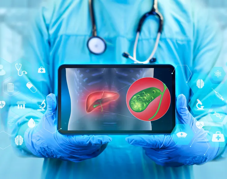How Do Doctors Decide on the Best Treatment for Gallbladder Cancer?