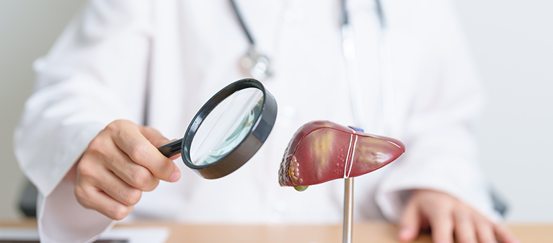 How Serious Is Liver Cancer at Different Stages?