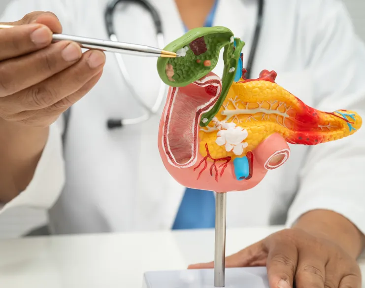 Questions to Ask Your Gallbladder Surgeon Before Surgery